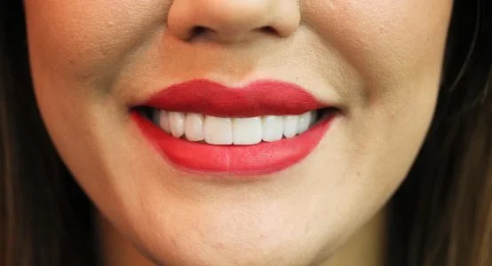 Imagem ilustrativa sobre lentes de contato dental